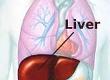 Alcohol and Liver Cirrhosis